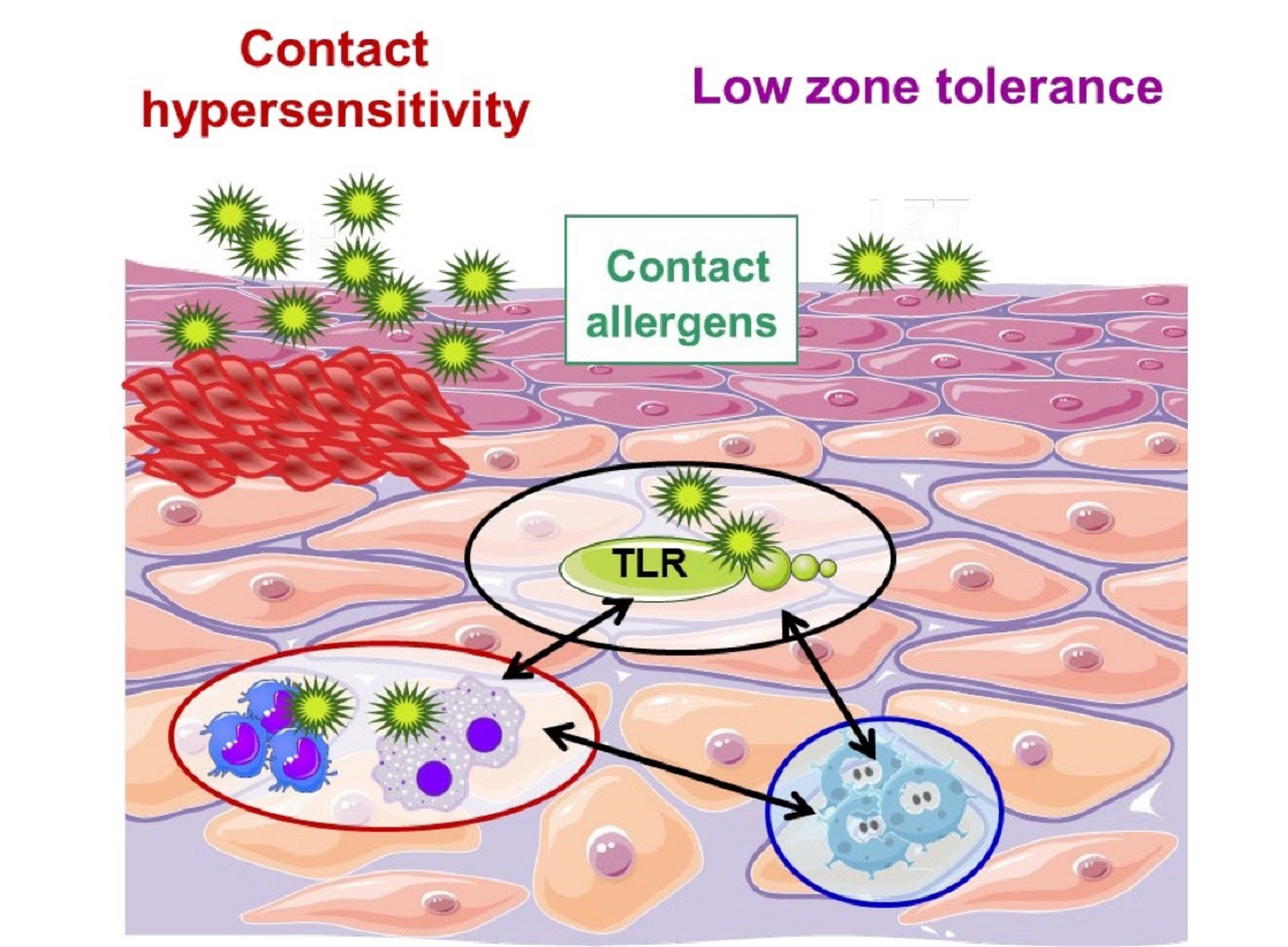 UKM Hautklinik | Forschung |  Wirkung von angeborenen Immunsignalen auf Hapten-spezifische Immunantworten
