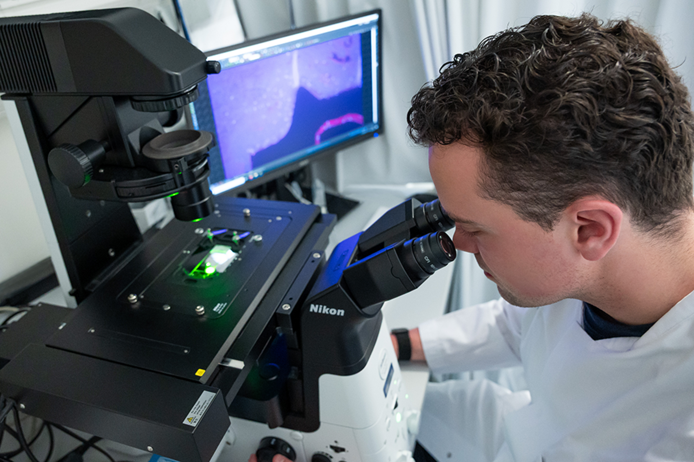 UKM | Forscher analysiert biologische Probe am Mikroskop im Forschungslabor der Gefäßchirurgie.