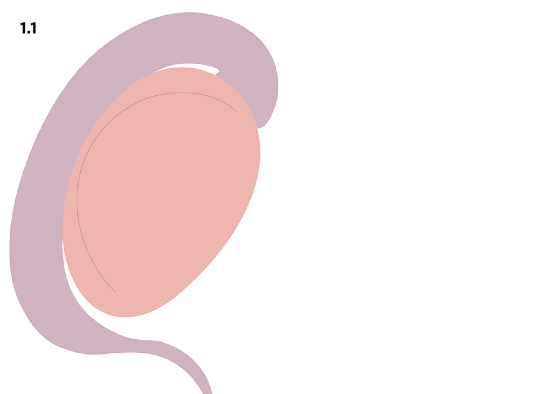 UKM Andrologie | Illustration Spermienextraktion