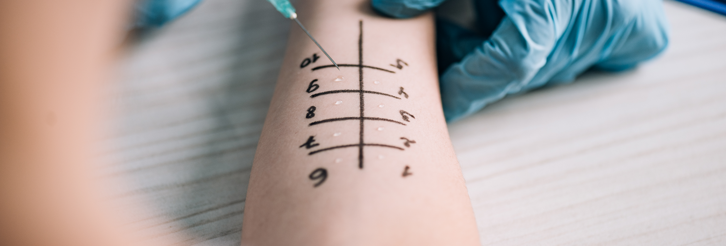 UKM | Allergiezentrum Nord-West