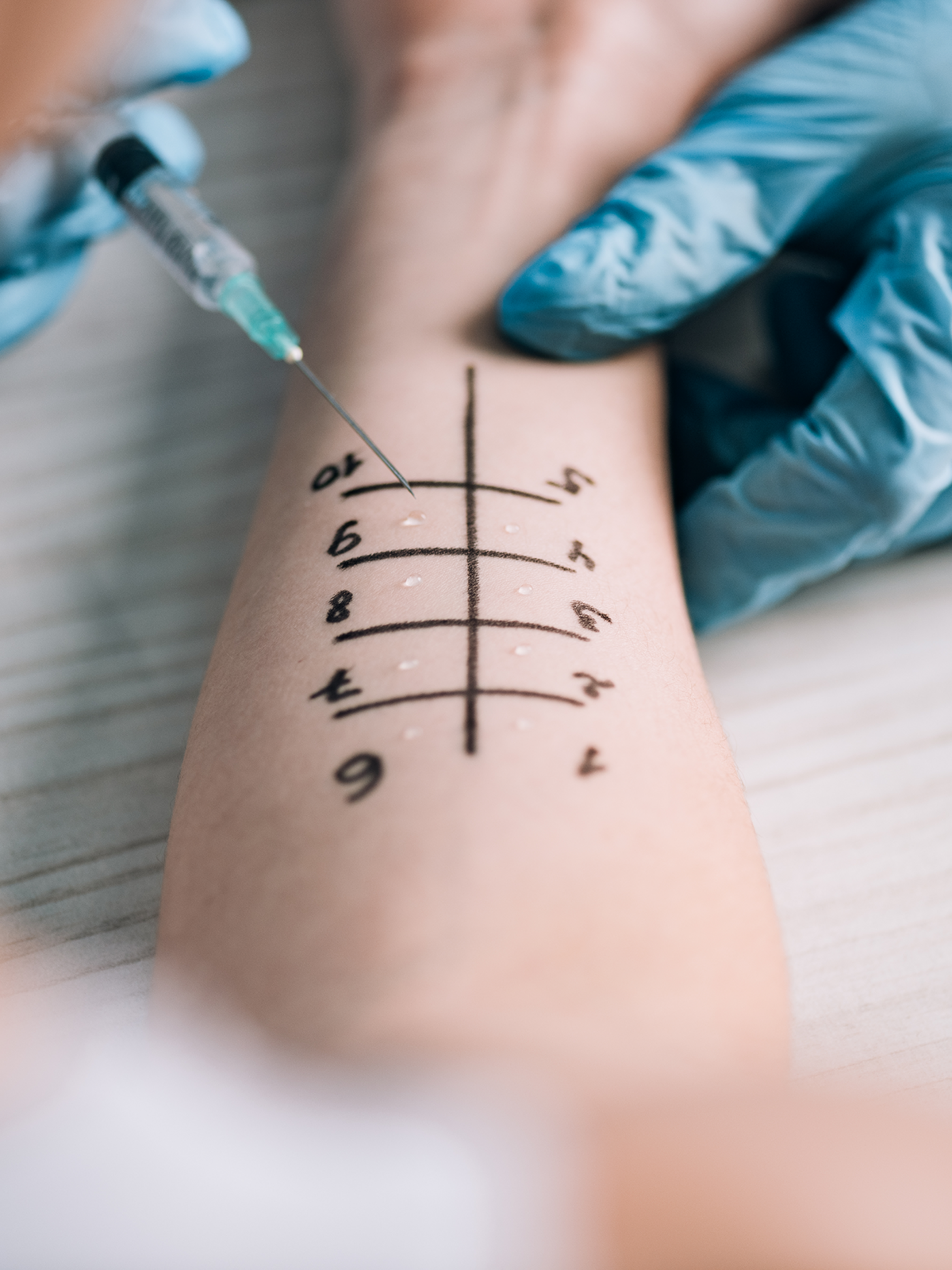 UKM | Allergiezentrum Nord-West