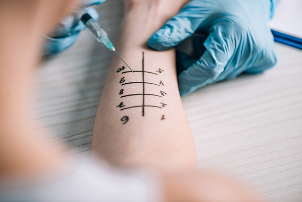 UKM Allergiezentrum Nord-West | Allergietest